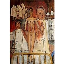 Frida Kahlo - Sezeryan Tablosu